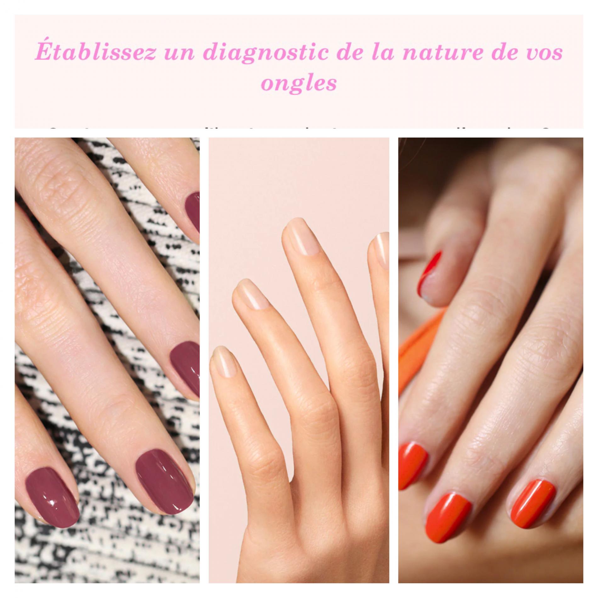 DIAGNOSTIC ONGLES